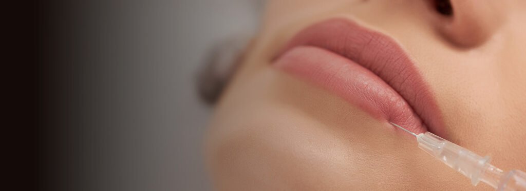 Preenchimento Labial em SJC